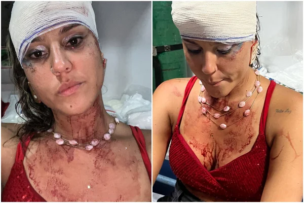 Imagem colorida mostra mulher que denunciou ter sido agredida em bloco de carnaval | Metrópoles
