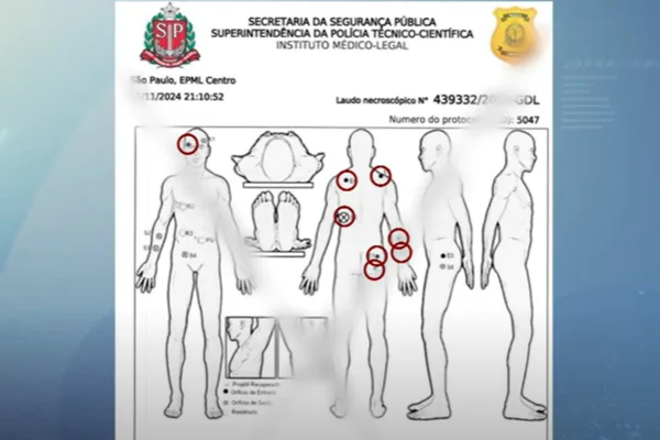 Imagem colorida de um laudo da polícia que mostra em círculos vermelhos os locais do corpo onde Gritzbach foi atingido - Metrópoles