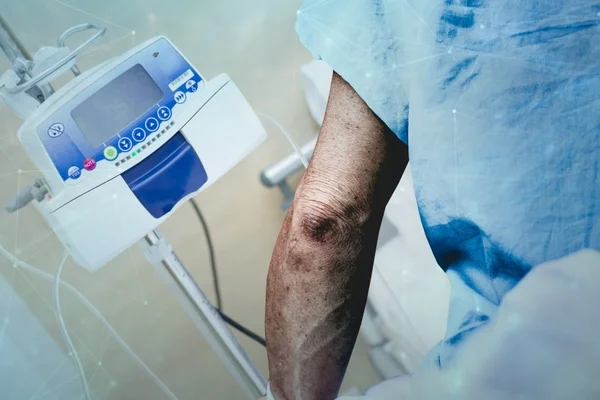 A Via-crúcis dos pacientes do DF que têm câncer