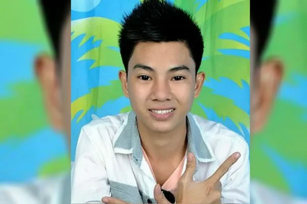Modelo filipino faz plástica no nariz e fica com rosto deformado