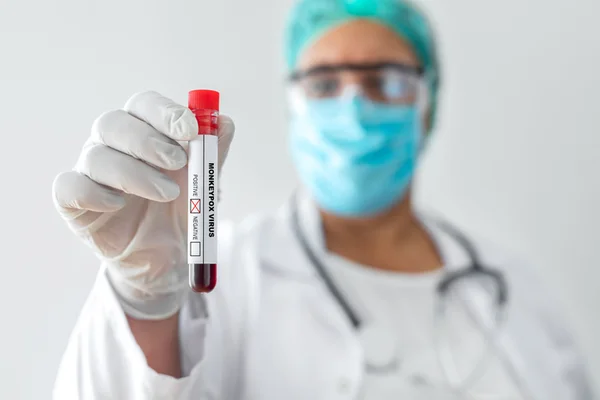 Pessoa segurando fraco com adesivo com a palavra Monkeypox- Metrópoles - mpox