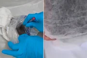 O material foi analisado pela equioe médica O material foi analisado pela equioe médica