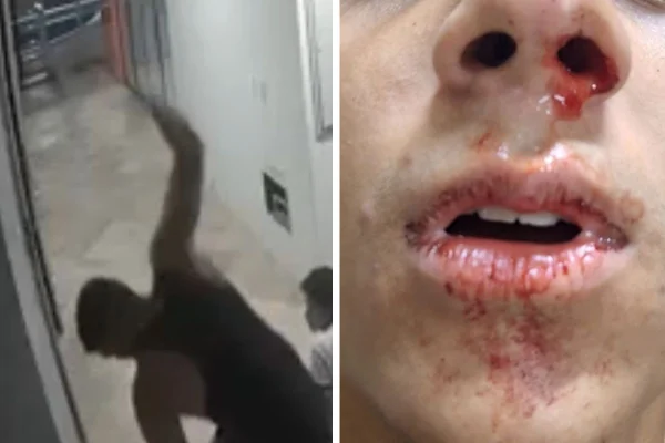 Montagem com fotos coloridas de PRF agredindo crianças e menino com o nariz sangrando