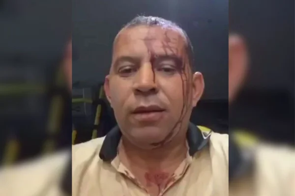 Imagem colorida de motorista de ônibus do RJ ferido- Metrópoles