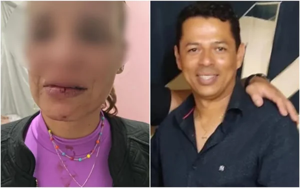 goias secretario preso por soco no rosto da esposa