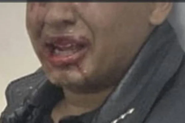 Um adolescente de 14 anos que possui transtorno do espectro autista (TEA) foi brutalmente agredido por seguranças do shopping Pier 21, em Brasília, na última sexta-feira (16/8). Após tentar assistir a um filme que tem classificação indicativa de 18 anos, o jovem foi retirado da sala de cinema e, em seguida, espancado por três seguranças, mesmo após se identificar como menor de idade.