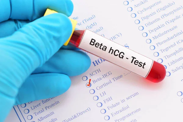 Foto colorida: mão com luva azul segura exame de sangue sobre lista de testes - Metrópoles