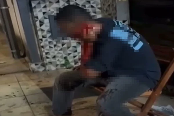 Sangue escorre por pescoço de homem atacado em bar no DF