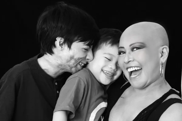 Foto colorida de das crianças abraçada na mãe careca - Metrópoles