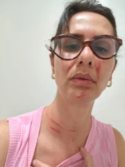 Enfermeira é agredida dentro de hospital público do DF - imagem 4 Enfermeira é agredida dentro de hospital público do DF - imagem 4