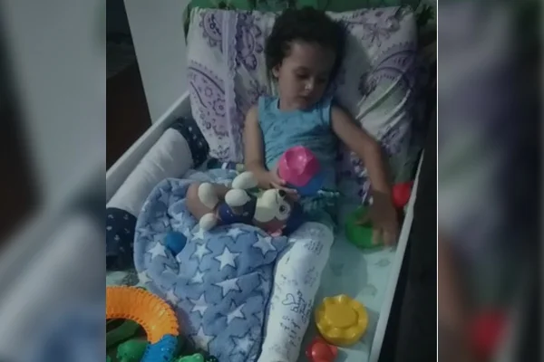 Vídeo: com a perna engessada, menino atropelado por carro recebe alta