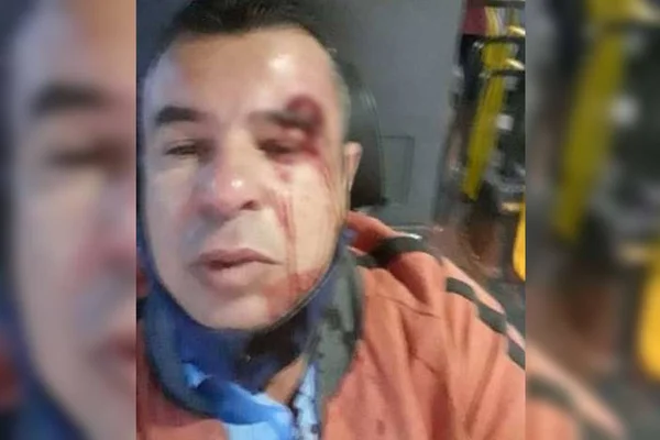 Motorista de ônibus com olho sangrando