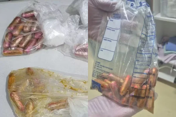 Imagem colorida de montagem com droga encontrada no intestino de boliviano. Metrópoles