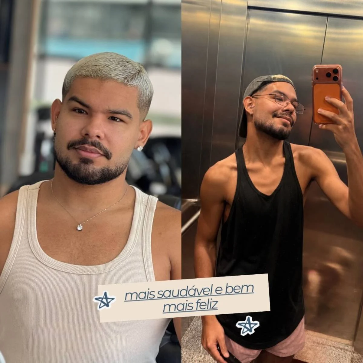 Vyni mostrou o antes e depois Vyni mostrou o antes e depois