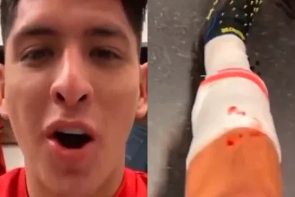 Edson Álvarez, do Ajax, mostra joelho cheio de sangue, ensanguentado, ferida