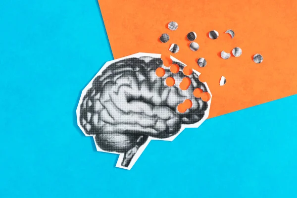 Ilustração de como a doença Alzheimer afeta o cérebro. Imagem em azul e laranja - Metrópoles.