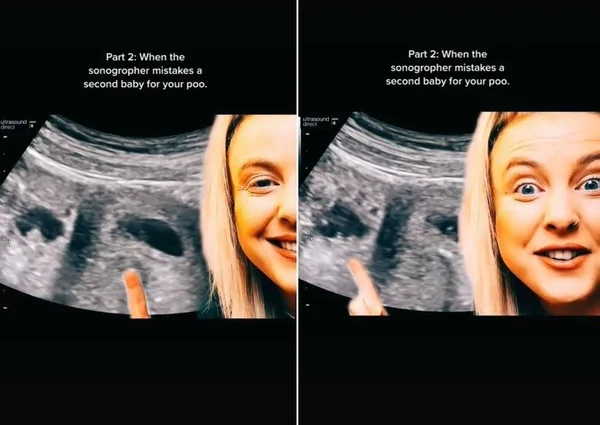 print de vídeo postado no TikTok