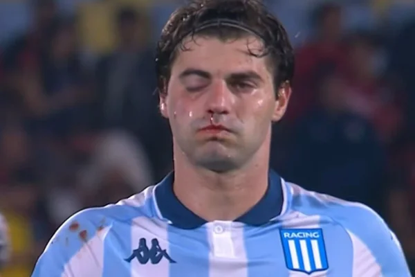 Zagueiro do Racing tem lesão após cotovelada em jogo contra Flamengo