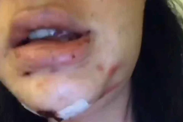 Alice, transexual agredida no rio de Janeiro