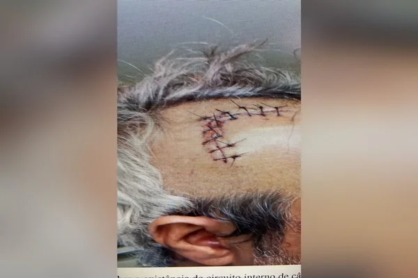 O crime foi praticado no dia 23/02/2023, por volta das 14h, em um apartamento situado na quadra 313 Norte, Asa Norte