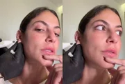 Mari Gonzalez se diverte ao descobrir reação pós-anestesia: “Louca” - imagem 3 Mari Gonzalez se diverte ao descobrir reação pós-anestesia: “Louca” - imagem 3