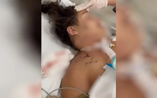 imagem colorida mulher esfaqueada pela ex do namorado