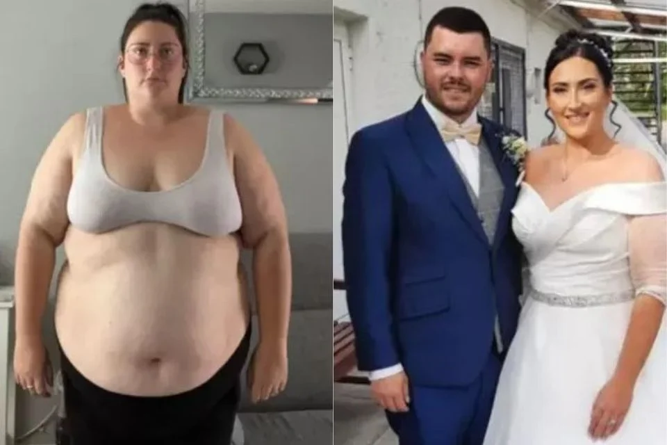 Mais uma imagem de antes e depois da jovem Mais uma imagem de antes e depois da jovem
