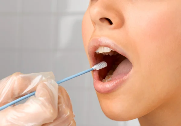 Foto mostra teste de saliva sendo realizado na boca de mulher com um cotonete largo - Metrópoles - DNA açúcar câncer
