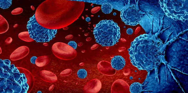 Ilustração mostra células do câncer, hemácias, atacadas por células cancerígenas azuis - Metrópoles