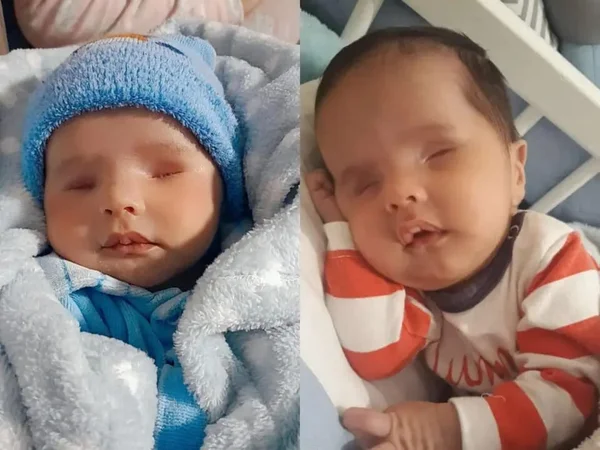 Família com bebê que não pode enxergar cai em golpe de falso médico