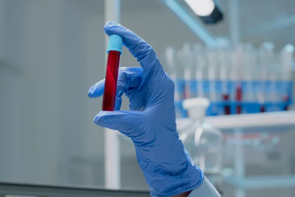 Close de um tubo de coleta a vácuo de vidro contendo solução de DNA para teste em laboratório químico. Mãos de médico com luvas segurando um frasco transparente com amostra de sangue para análise laboratorial. Metrópoles