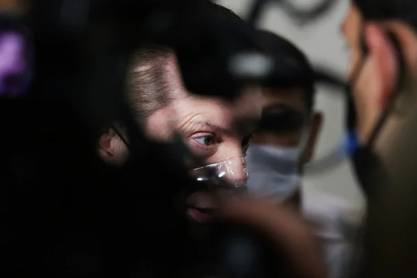 olhos de russomanno