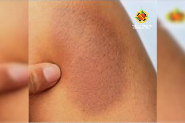 DF: agressivo, homem é preso após quebrar ônibus e bater em passageira