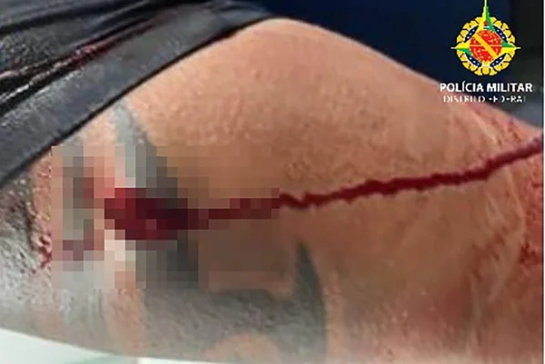 Homem é preso depois de desferir facada em policial