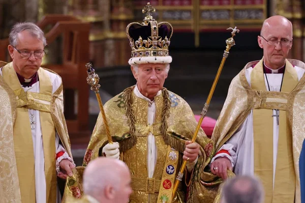“Dedos de salsicha” do rei Charles III chamam atenção na coroação