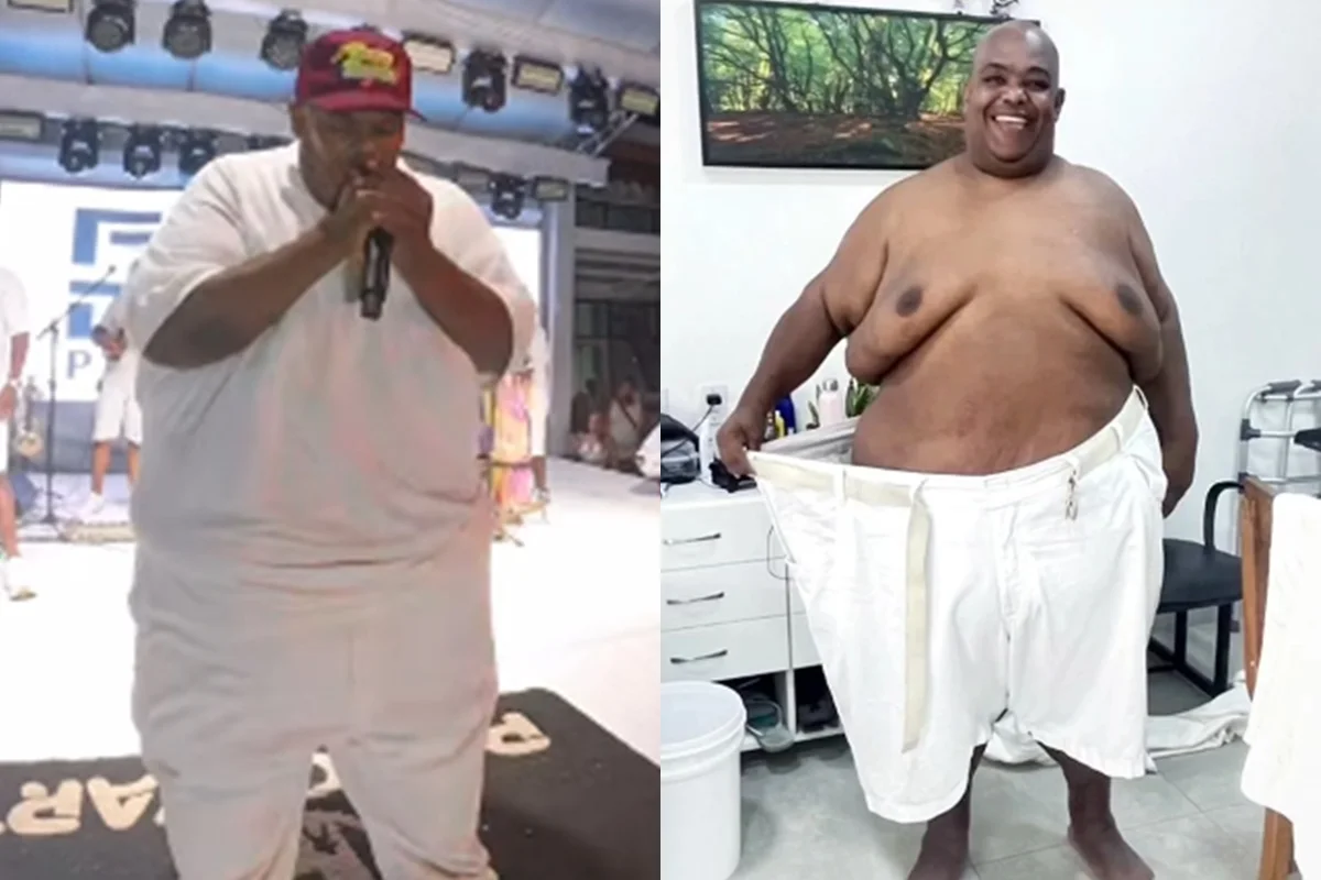 Cantor Luciano Babu impressionou os fãs com a luta contra a obesidade mórbida Cantor Luciano Babu impressionou os fãs com a luta contra a obesidade mórbida