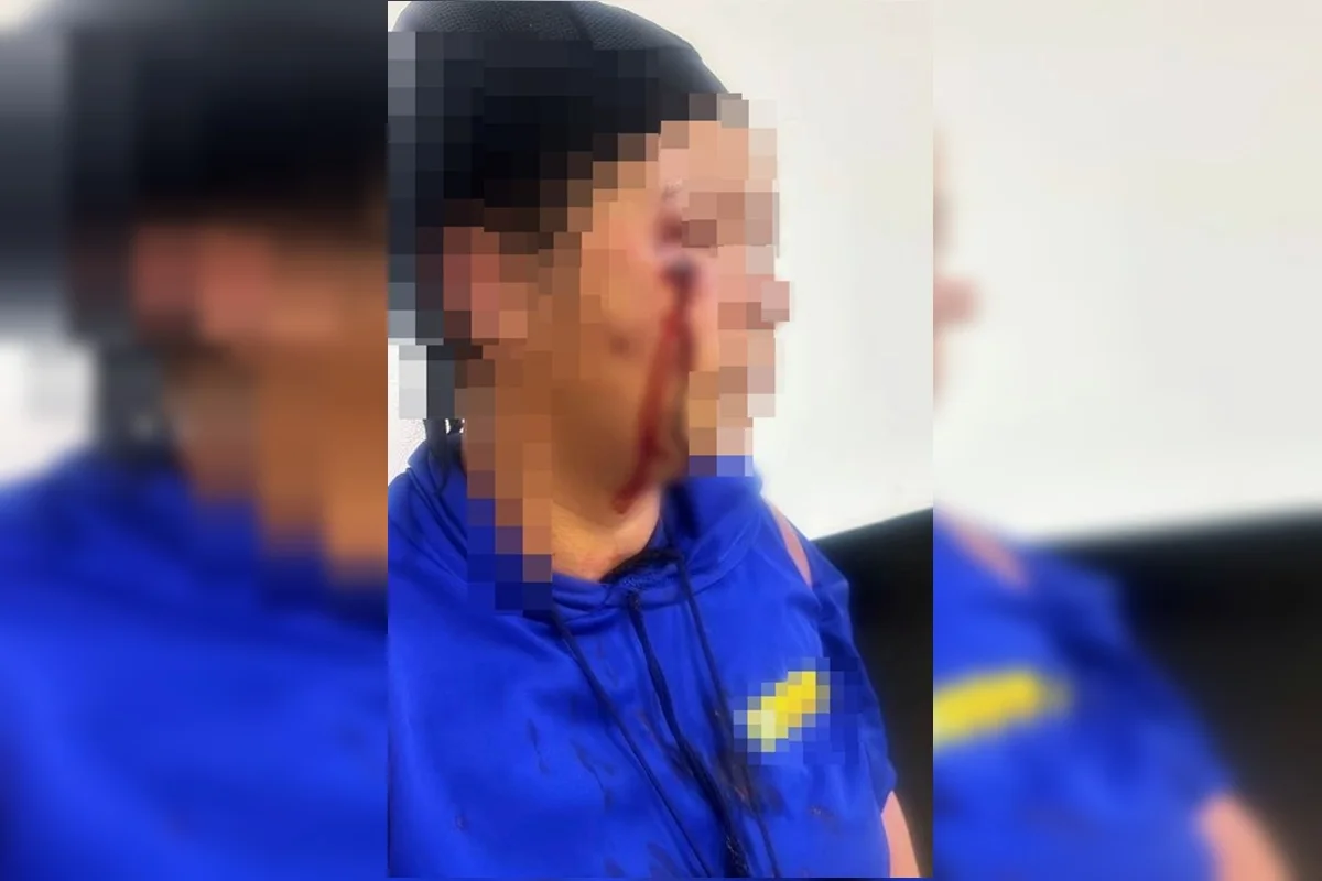 Mulher é chicoteada por outras duas mulheres em Cristalina Mulher é chicoteada por outras duas mulheres em Cristalina