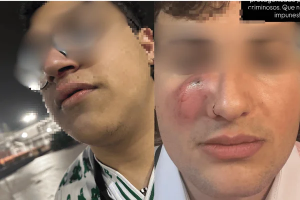 alunos unifesp agressao vereador PL