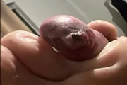 Cozinheiro desistiu do MasterChef após ser picado por aranha: veja fotos - imagem 4 Cozinheiro desistiu do MasterChef após ser picado por aranha: veja fotos - imagem 4