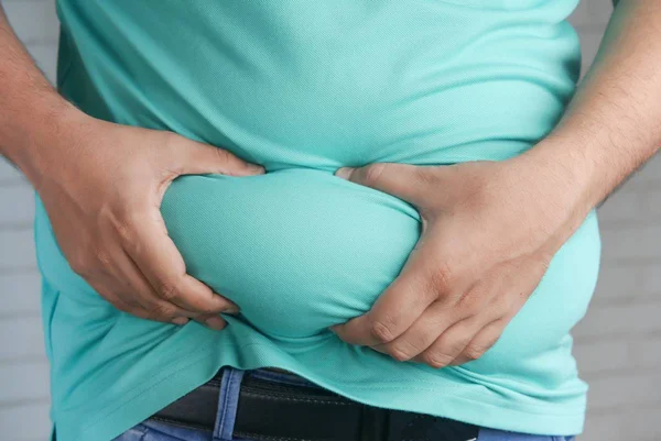 Foto colorida de pessoa obesa - sarcobesidade