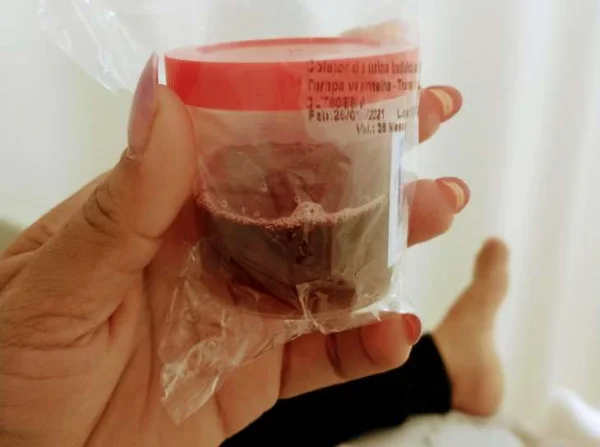 Jovens são hospitalizados com doença da urina preta