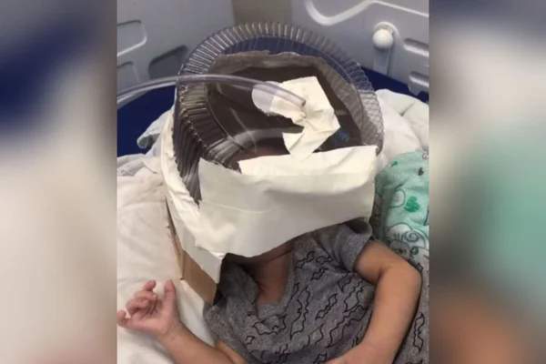 Hospital usa embalagem de bolo como máscara de oxigênio em bebê de 3 meses