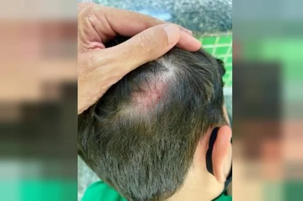 menino ferido