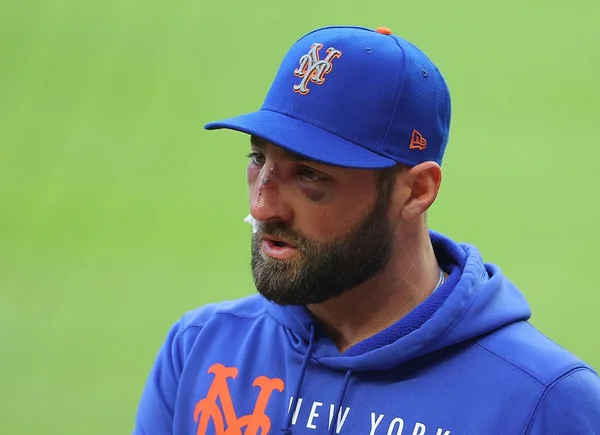 Kevin Pillar com o rosto machucado