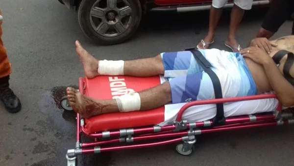 Homem tem corte profundo nas pernas após topar com linha de pipa no DF