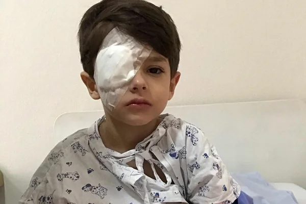 Mãe se desespera após filho queimar olho com álcool em gel: “Tremia de dor”
