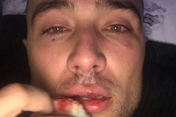 Depois de vídeo, policiais são afastados por agressão a publicitário