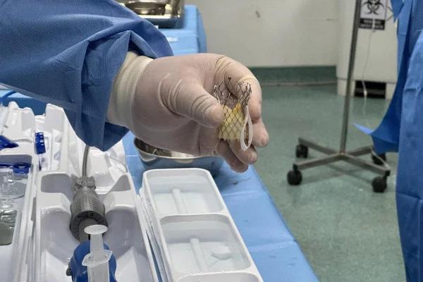 Implante de válvula aórtica transcateter. Imagem da prótese antes de ser implantada. Metrópoles