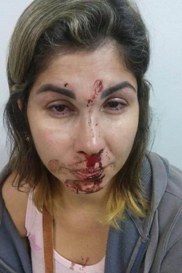 Filho denuncia pelo Facebook violência doméstica sofrida pela mãe