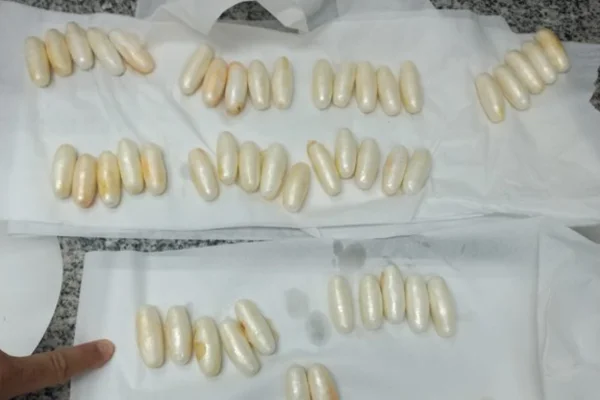 Foto colorida de cocaína ingerida por homem preso em flagrante enquanto tentava embarcar para Paris, França